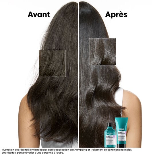 Shampooing dermo-r&eacute;gulateur anti-inconfort Scalp Advanced 300ml