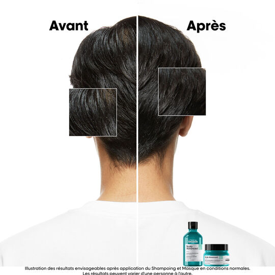 Shampooing dermo-purifiant anti-gras Scalp Advanced 300ml
