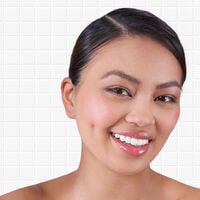 Shampooing cuir chevelu &agrave; probl&egrave;mes Scalp