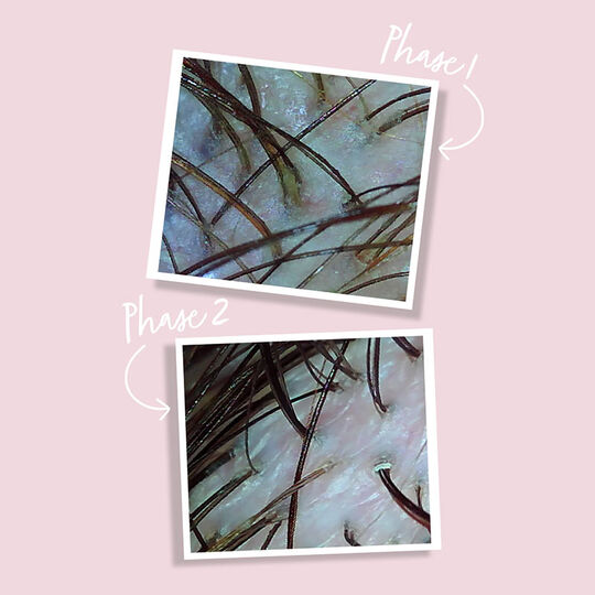 Huile d&eacute;toxifiante Scalp Detox Oil Treatment