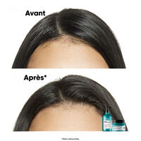 Shampooing dermo-purifiant anti-gras Scalp Advanced 1500ml