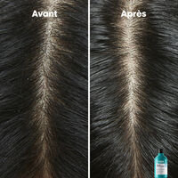 Shampooing dermo-clarifiant anti-pelliculaire Scalp Advanced 500ml