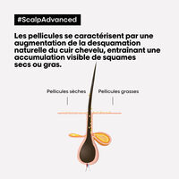 Shampooing dermo-clarifiant anti-pelliculaire Scalp Advanced 500ml,  Shampooing dermo-clarifiant anti-pelliculaire Scalp Advanced 500ml