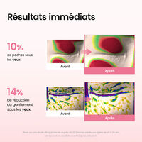Patchs pour les yeux aux peptides de collag&egrave;ne