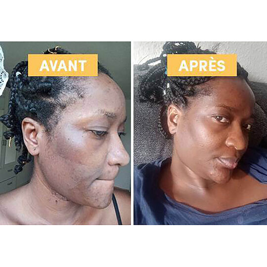 Mac&eacute;rat huileux de busserole