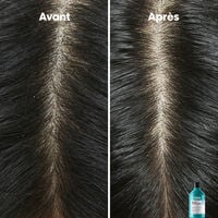 Shampooing dermo-clarifiant anti-pelliculaire Scalp Advanced 300ml