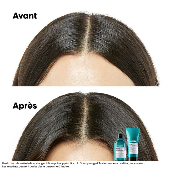 Shampooing dermo-r&eacute;gulateur anti-inconfort Scalp Advanced 300ml