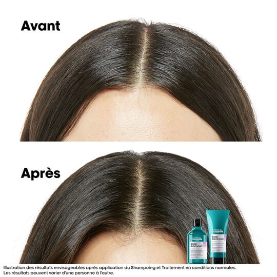 Shampooing dermo-r&eacute;gulateur anti-inconfort Scalp Advanced 300ml